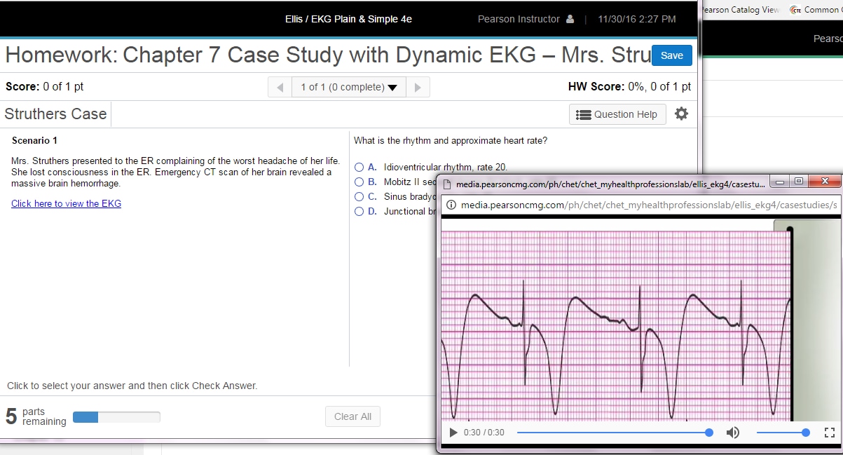 Ellis Dynamic EKG Strip